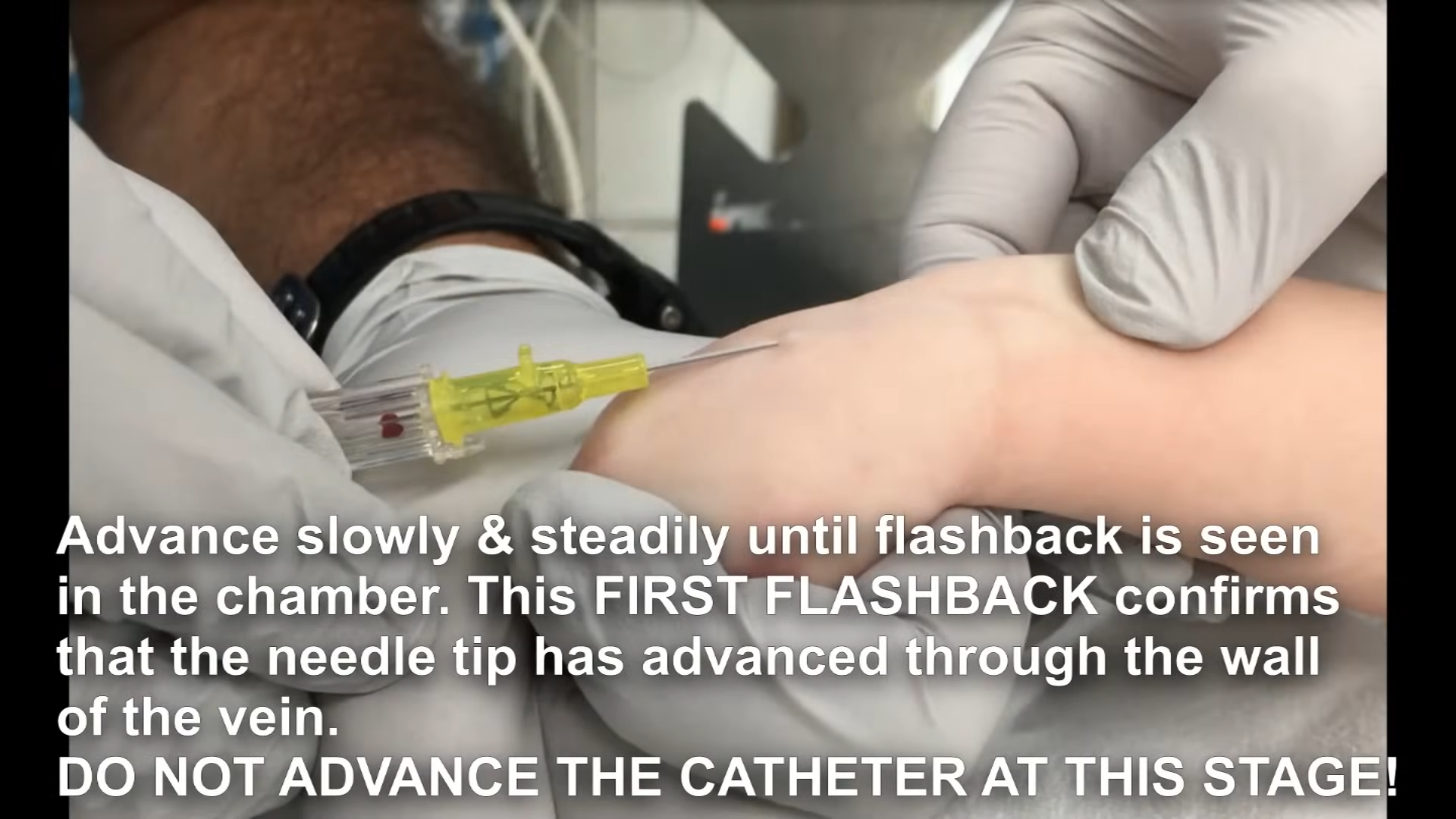 First flashback seen in chamber